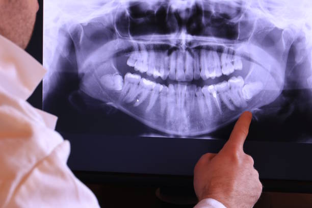 Best Emergency Treatment for Dental Infections or Abscesses in Mclean, VA