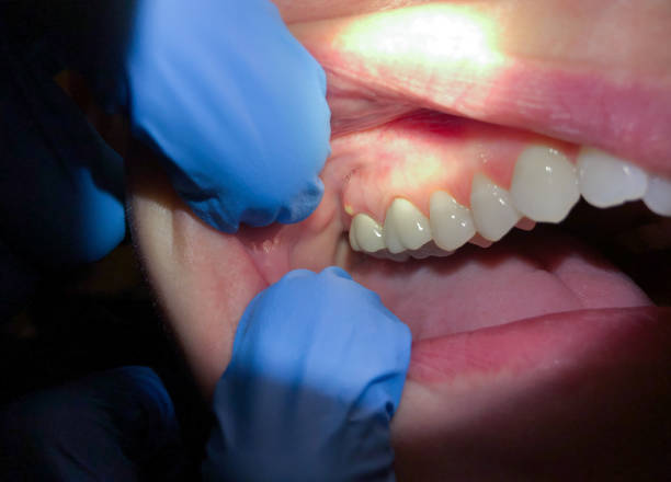 Best Weekend Emergency Dentist in Mclean, VA