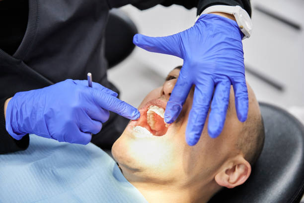 Best Emergency Root Canal Treatment in Mclean, VA