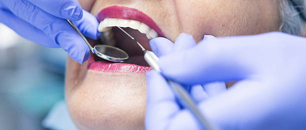 Best After-Hours Dental Trauma Care in Mclean, VA